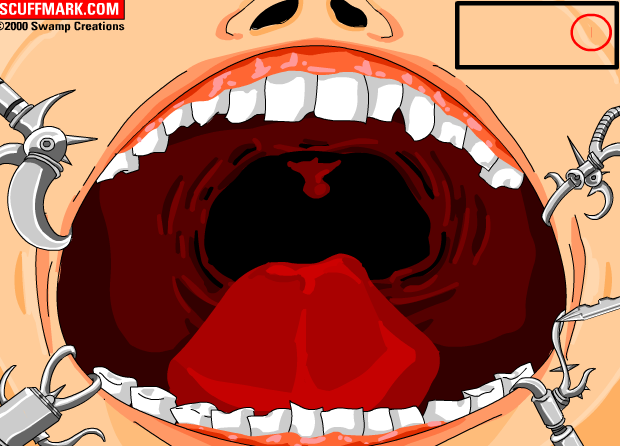 Взрывающиеся зубы